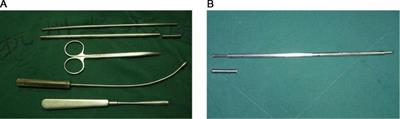 Case Report: Improved surgical treatment for breast capsular contracture by the punctiform-incision approach through the nipple